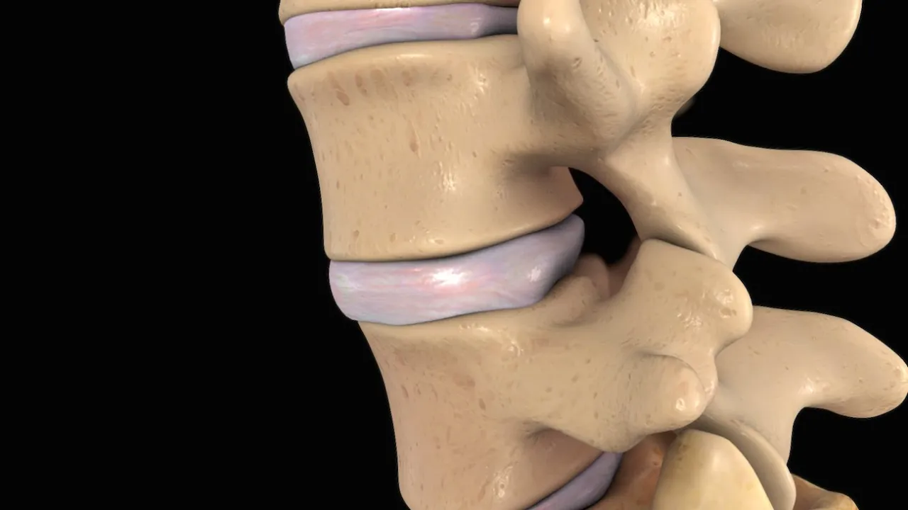 Low Back Pain -   Disc  Herniation ,Sciatica  - Everything You Need To Know - Dr. Nabil Ebraheim. 