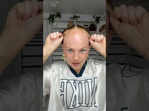 ￼Did this look like a wig at first glance???? #alopecia