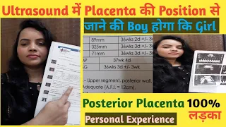 Download Placenta posterior means boy or girl | Placenta anterior means boy or girl | Baby boy symptoms MP3
