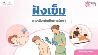 การฝังเข็มสามารถรักษาโรคอะไรได้บ้าง