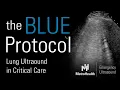 Download Lagu The BLUE Protocol