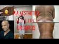 MIA AESTHETICS DR GIORGIS LIPO360 HOURS AFTER SURGERY