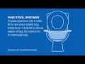 How to collect a fecal specimen for patients