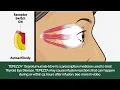 How TEPEZZA Works to Treat Thyroid Eye Disease TED