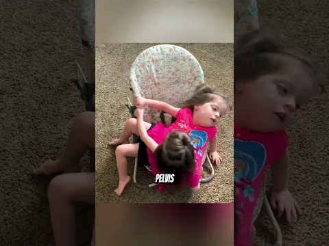 Tres niños enfrentando desafíos que la mayoría no puede imaginar — el último es increíble 😨