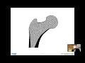 Topology Optimization - and Deep Learning-Based Bone Microstructure Reconstruction from CT Scan Data