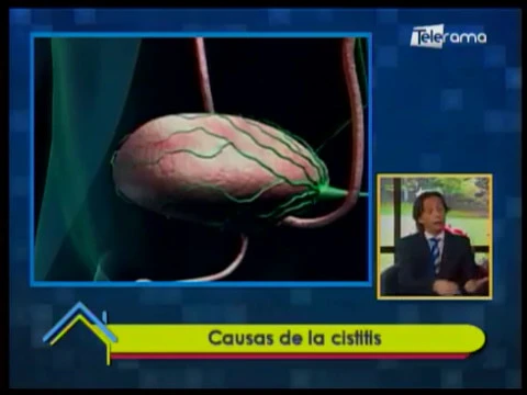 Causas de la cistitis