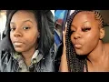 NO CLICKBAIT HOW I CLEARED MY ACNE How to get rid of dark marks scars UNDER 20