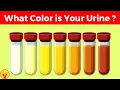 What Your Urine Color Says About Your Health Urinary System Breakdown VisitJoy