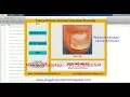 Fingernail Disease Detection Using Image Processing Matlab Project With Source Code