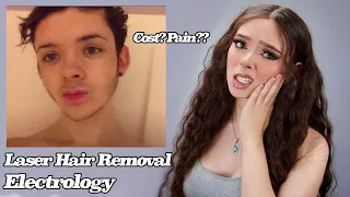 Laser Hair Electrolysis - My Experience