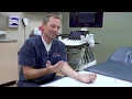 How Do I Know If I Have Carpal Tunnel Syndrome