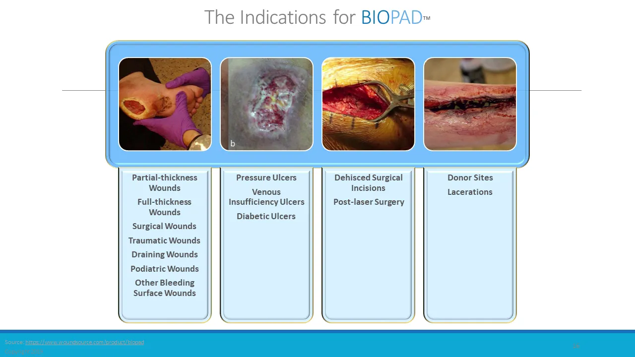 Webinar: Healing Wounds with Collagen: Knowing the Difference Makes All the Difference