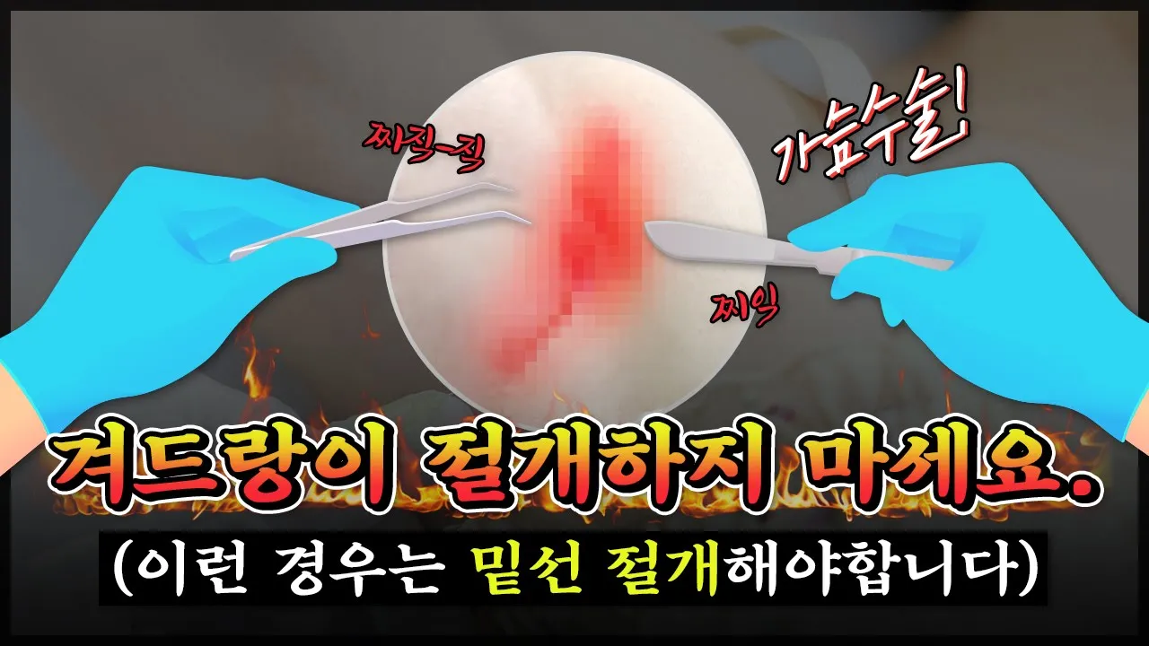 [가슴수술] 겨드랑이 절개하지 마세요. 밑선 절개하셔야 합니다
