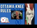 Ottawa knee rules explained - Knee Xray guidelines