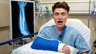 I Broke my Arm (Not Click Bait)