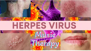 Download Herpes /  Music therapy /  Recommendations MP3