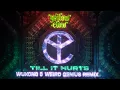 Download Lagu TILL IT HURTS - YELLOW CLAW (WUKONG \u0026 WEIRD GENIUS REMIX )