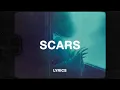 Download Lagu Ondi Vil - Scars (Lyrics) ft. Mishaal