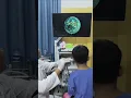 Deep Earwax Extraction with Endoscope View