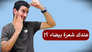 كيف تتخلص نهائيا من شيب الشعر المبكر قبل ان يصبح شيب دائم   نصيحة مهمة لمن تجاوز ال    دندنها