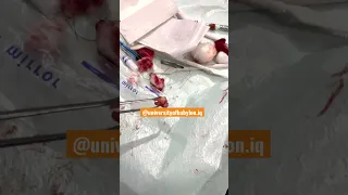 جامعه بغداد كليه طب الاسنان جوله سريعه 