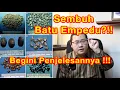 Lagu Batu Empedu, Sembuhkan ?!! Begini Caranya tanpa Obat !!!