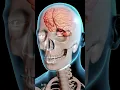 How Does a Concussion Affect Your Brain