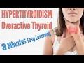Hyperthyroidism Overactive thyroid causes symptoms risk factor treatment 3 minutes learning