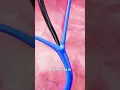 Channel