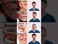 Download Lagu Friends with slumped faces look over, each action lasts for 30 seconds, cycle 4 groups #facelift. Download Lagu Friends with slumped faces look over, each action lasts for 30 seconds, cycle 4 groups #facelift.