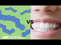 New way to prevent tooth decay