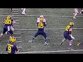 Zak Zinter Leg Injury