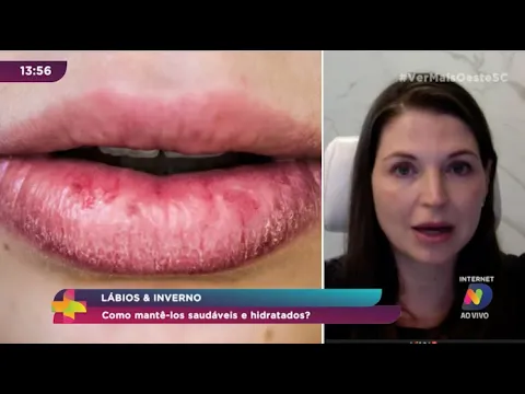 Como manter os lábios saudáveis e hidratados no inverno?