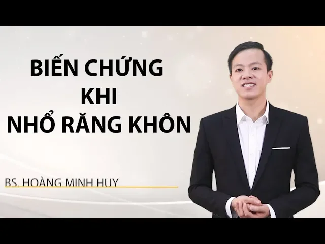 Outline Video Nhổ răng khôn có nguy hiểm không? Những biến chứng có thể gặp phải khi Nhổ răng khôn