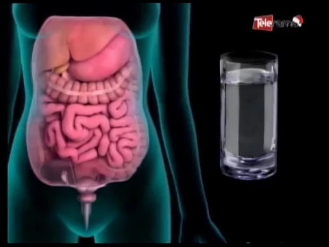 Cómo afecta el estrés a la gastritis