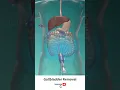 Download Lagu Gallbladder Removal Surgery ↪ 3D Medical Animation #Shorts #Gallbladder