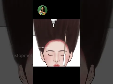 ASMR dead skin explosion! Big Flakes Dandruff Scratching Animation| Head Lice #animation #asmr