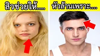 สิวสามารถชะลอความแก่ได้หรือไม่ และทำไมจึงเป็นเช่นนั้น