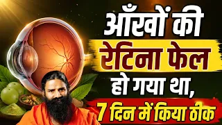 आँखों की रेटिना फेल हो गया था, 7 दिन में किया ठीक || Swami Ramdev