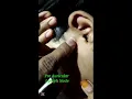 Pre Auricular Lymph Node