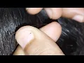 Download Lagu Nitpicking ASMR video  256         #nitpicking #asmr #kuto #piolhos #petantumo  #licepicking