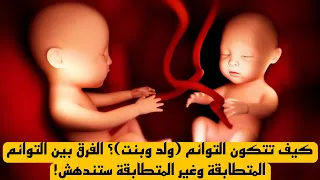 كيف تتكون التوائم  ولد وبنت   الفرق بين التوائم المتطابقة وغير المتطابقة ستندهش  دندنها