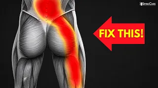How to Fix a Pinched Nerve in Lower Back & Leg (INSTANT RELIEF)