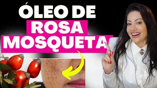 ROSEHIP OIL lightens SPOTS and MELASMA? The Revealed Truth | Dr. Greice Moraes