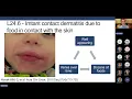 A Practical Guide for Food Introduction and Allergy Prevention