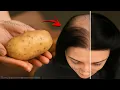 Download Lagu 🌱 Hair Grows Like Crazy \u0026 Stops Falling Out! 💥 The Most Powerful Natural Recipes! Hair Growth Tips 🌿