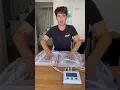 Download Lagu Electricity can stop sweating… #hyperhidrosis #amazon #amazonfinds #amazonhaul #fyp