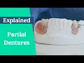 Partial dentures false teeth explained