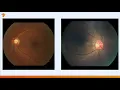 Introduction to TensorFlow 2 0 - Brad Miro Google